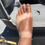 A tan-lined foot of Ty Hallock mid guide season.